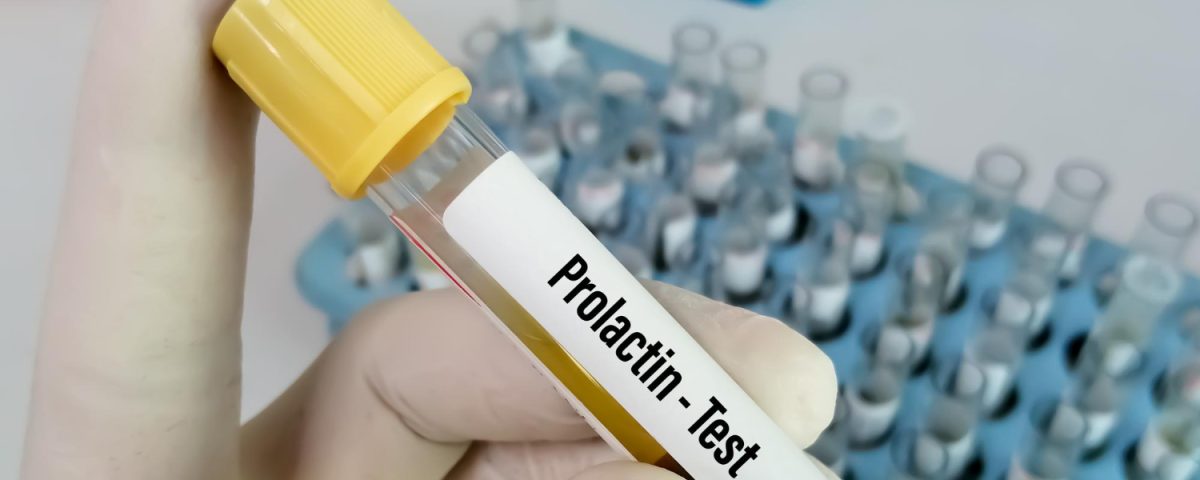 προλακτίνη