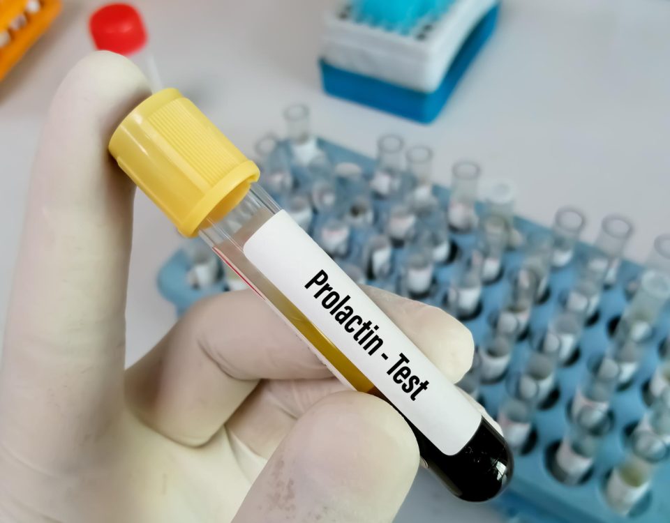προλακτίνη
